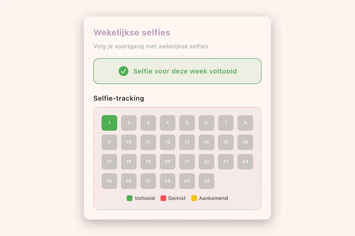 Weekly selfie tracking screen from the patient app, showing a 30 day clinical trial schedule in Dutch with completed, missed and upcoming states.